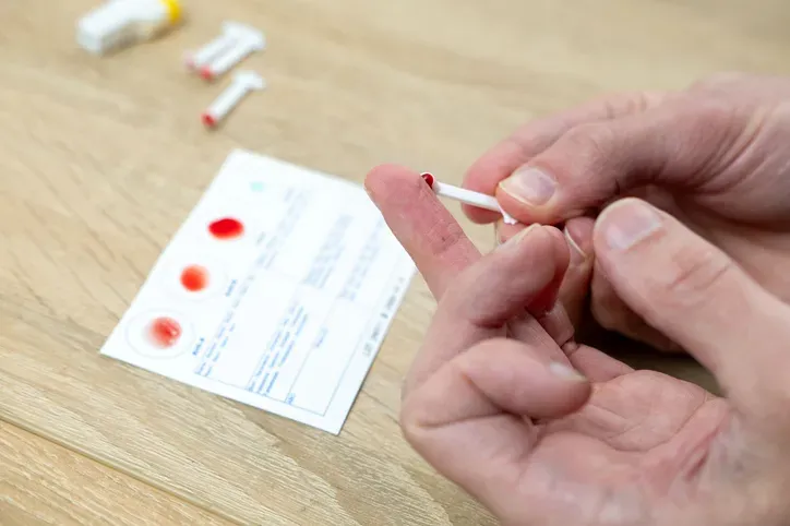 Ortaya çıkan veriler, kan grubu genleri ile erken yaşta geçirilen felç arasında istatistiksel olarak anlamlı bir bağlantı olduğunu net bir şekilde gösterdi: A Kan Grubu: 60 yaş öncesi inme geçirme ihtimali, diğer kan gruplarına kıyasla %16 daha yüksek . 0 (Sıfır) Kan Grubu: Aynı yaş grubunda erken inme geçirme riski %12 oranında daha düşük . B Kan Grubu: Yaş faktöründen bağımsız olarak, felç geçirme riski genel popülasyona göre yaklaşık %11 daha yüksek .